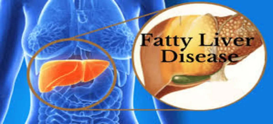 Fatty Liver Diseases Ayurvedic Remedies to Treat it