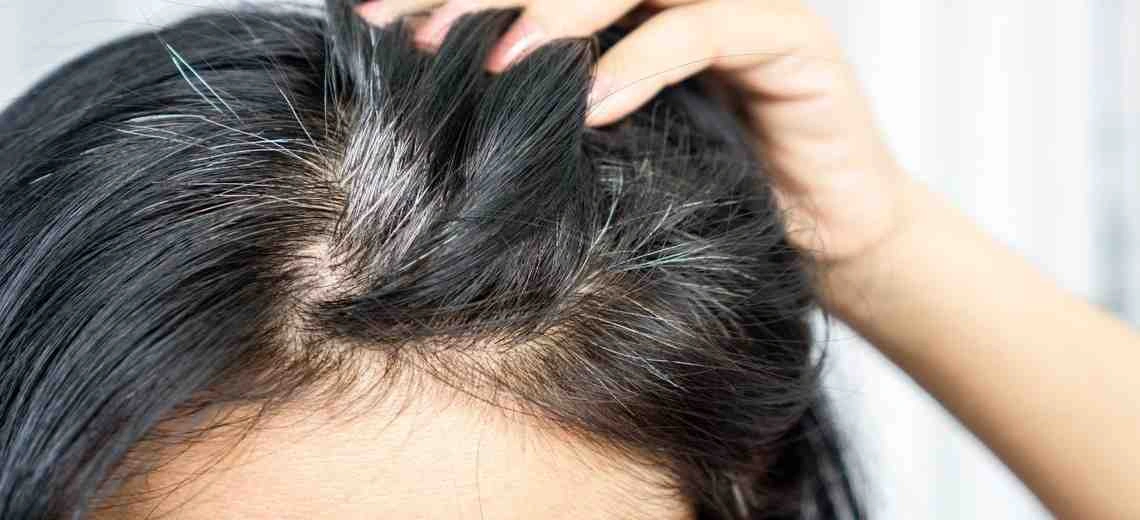 goodbye to pre mature grey hair