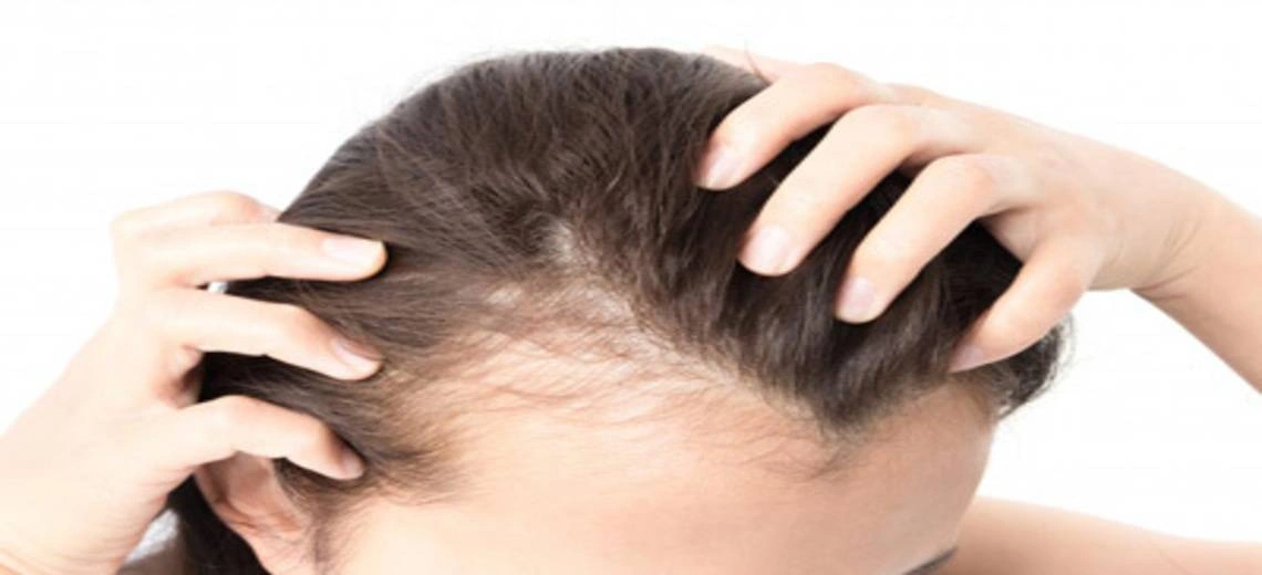 Traya hair product for hair loss