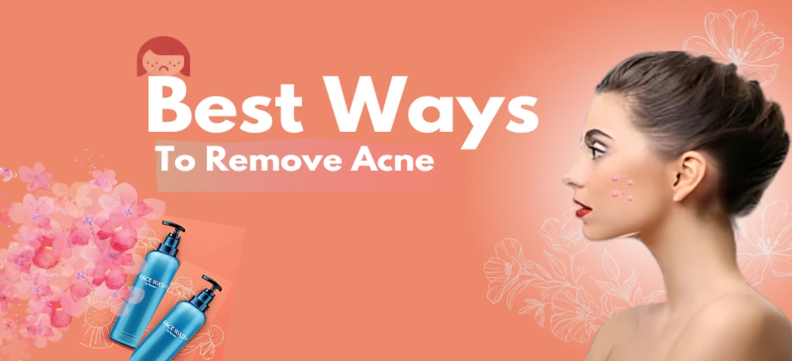 Best ways to remove acne